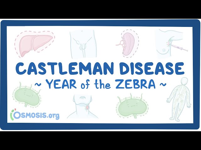 Castleman Disease