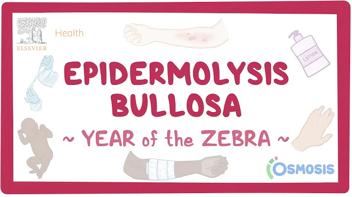 Epidermolysis bullosa