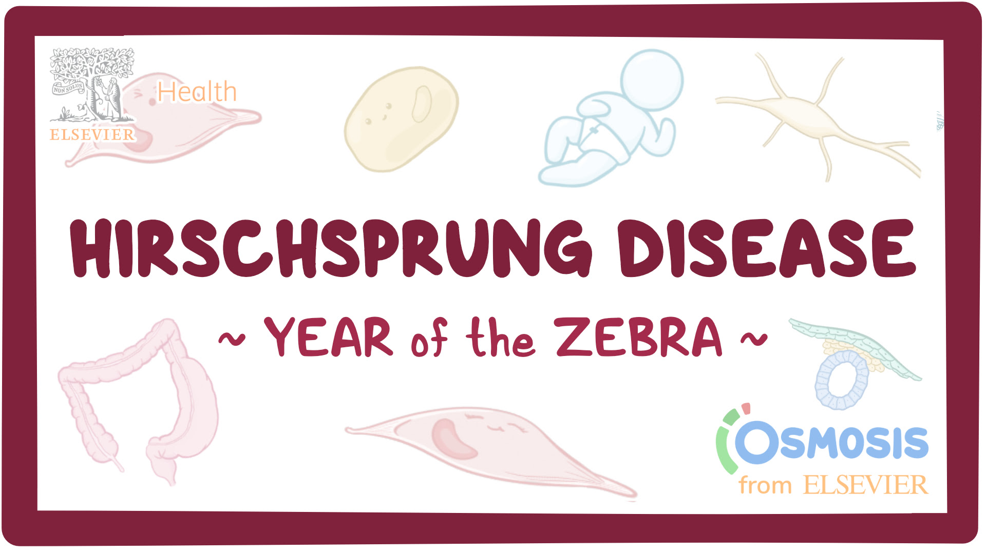 Hirschsprung Disease