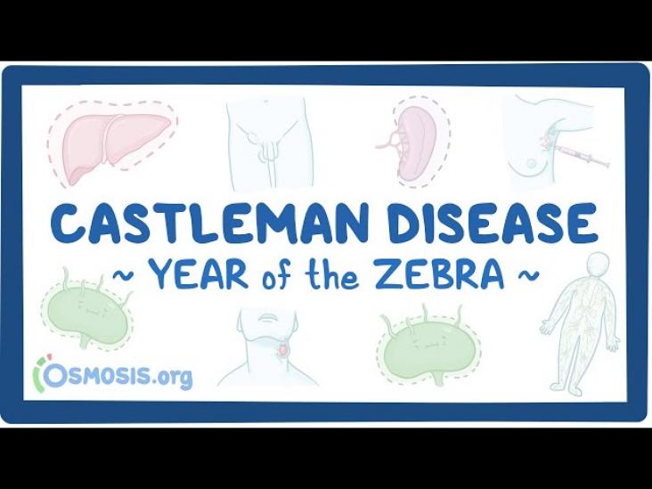 Castleman Disease