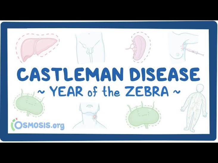 Castleman Disease