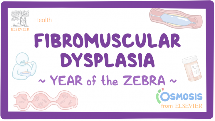 Fibromuscular Dysplasia