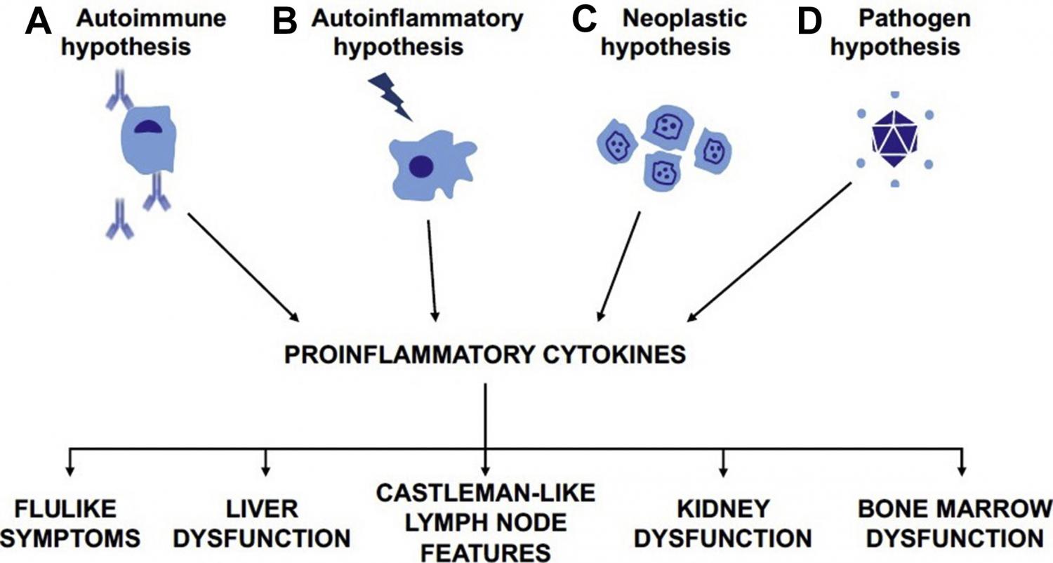 The CD research community, led by the CDCN, recently proposed 4 candidate etiologic drivers of iMCD pathogenesis: iMCD may be due to (A) self-reactive antibodies, (B) germline mutations in genes regulating inflammation, (C) acquired oncogenic mutations, o