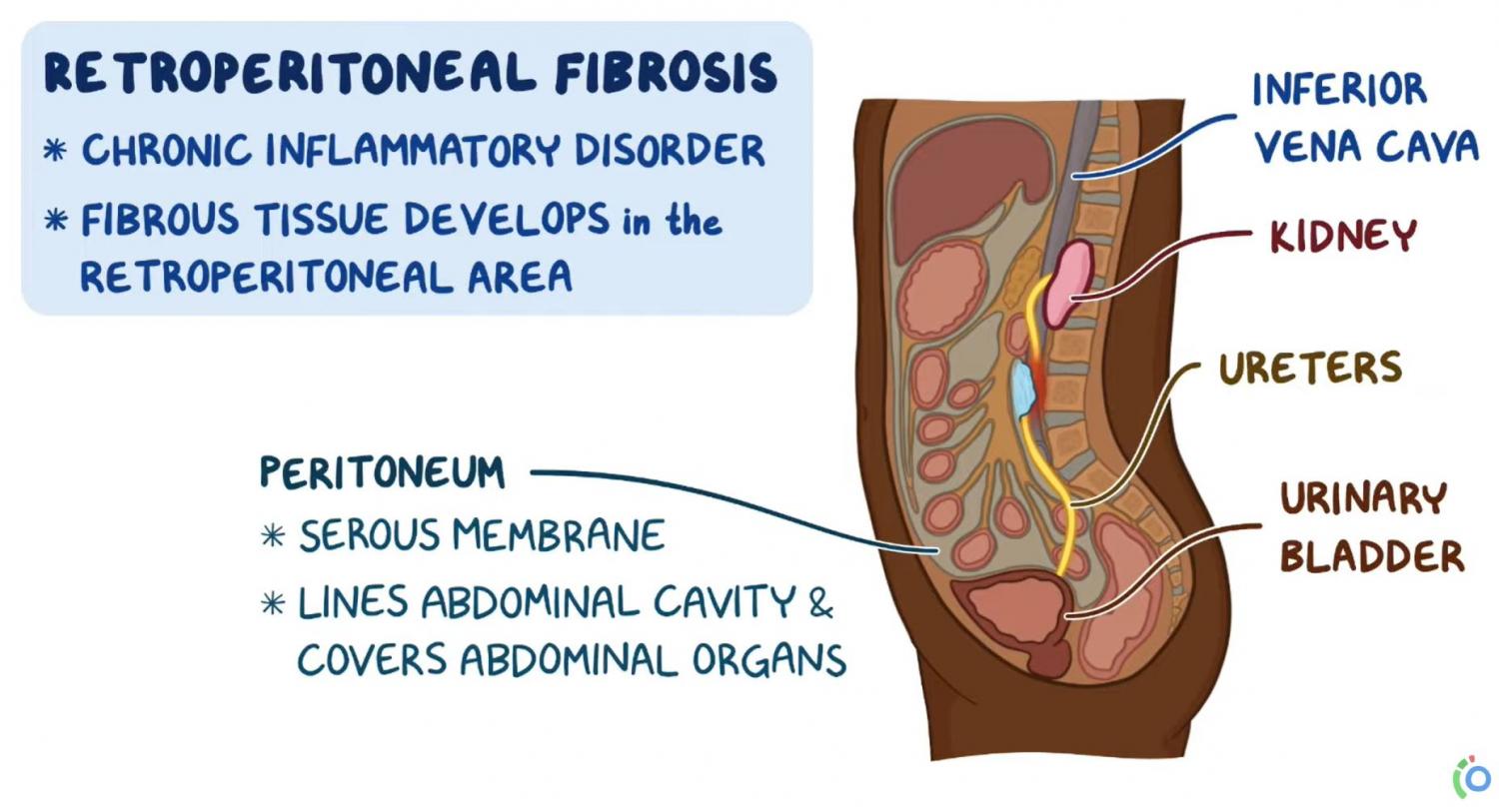 Diagram of the disease