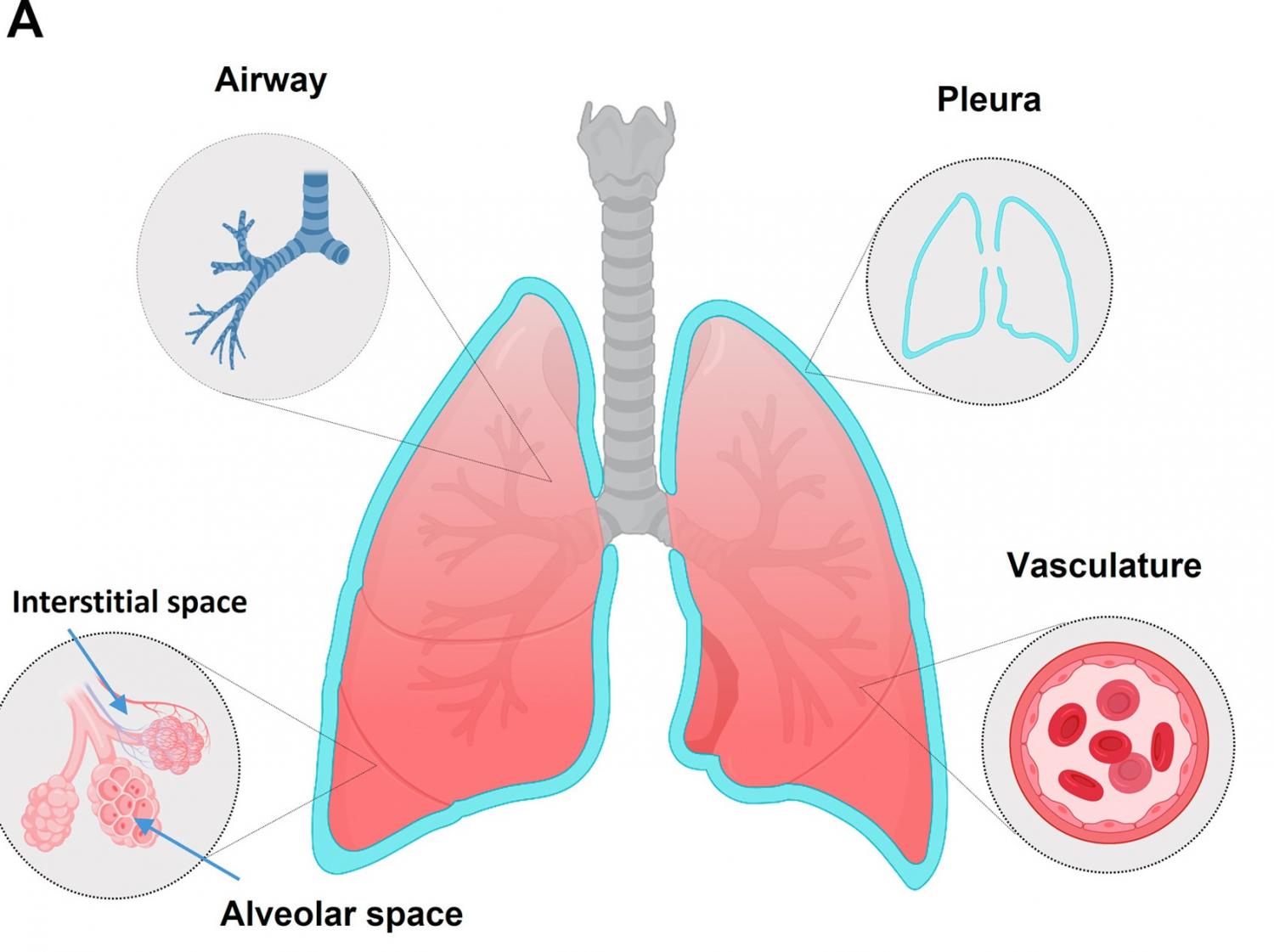 Lung disease patterns in IEI The lung compartments affected by pulmonary manifestations of IEI include the airways, alveolar space, interstitial space, vasculature, and the pleural space