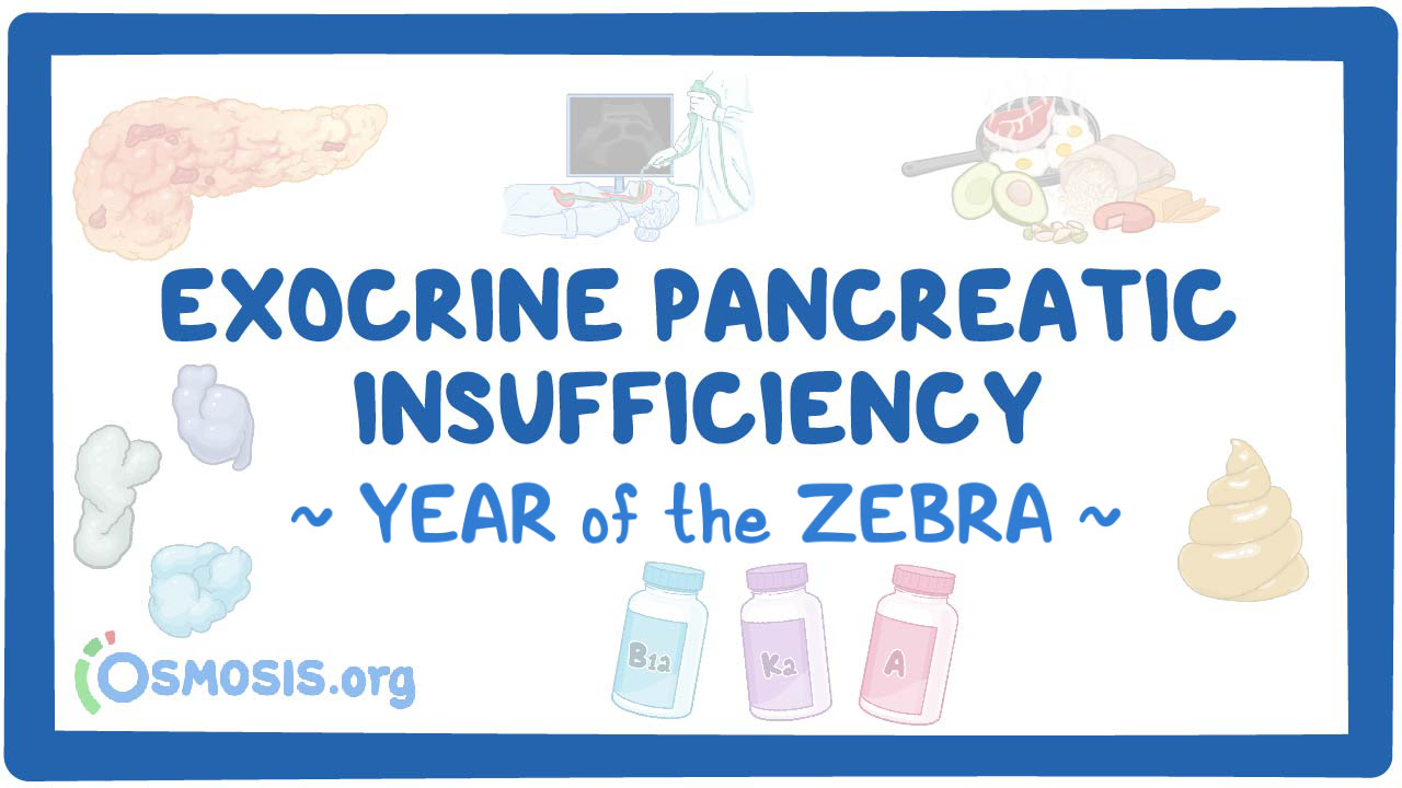 Zebra of the Month: Exocrine Pancreatic Insufficiency